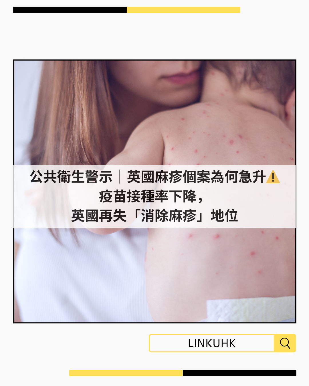英國麻疹個案急升｜為何失去消除地位？疫苗接種率下降成主因